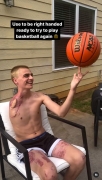 popular-tiktoker-with-one-arm-collab-porn-fucking-some-pussy-first-time-after-accident-1